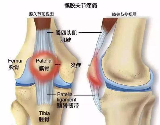 李華錘療,錘正療法,錘正療法工具